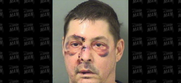 Florida Man Drives Around with Electrical Wires Wrapped around Penis