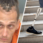 Florida Man Tries to Smuggle Drugs Into Jail With Prosthetic Leg